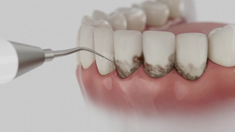 Trusted Dental Crowns And Bridges service in Holly, MI - Dentist Open Now